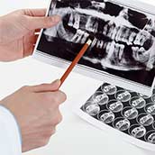 TAC Dental Completo