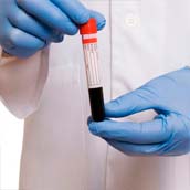 Pruebas preoperatorias de Tipo III