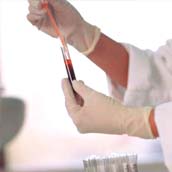 Analítica de Sangre y Orina Completa Analítica de Sangre y Orina Completa