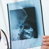 Radiografía del Cráneo en Barcelona  AMEDICS Centre Mèdic  al precio de 17€