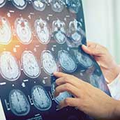 Resonancia Magnética Abierta Cerebral Resonancia Magnética Abierta Cerebral