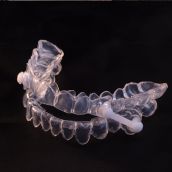 Dispositivo de Avance Mandibular (DAM) para Apnea del Sueño