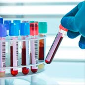 (ETS) Analítica de Prevención de Enfermedades Infecciosas y de Transmisión Sexual