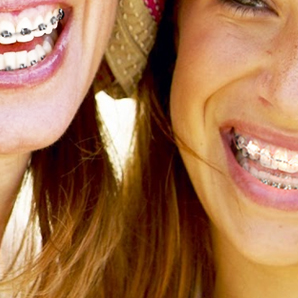 Ortodoncia Fija con Brackets Estéticos de Zafiro