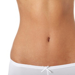 Abdominoplastia