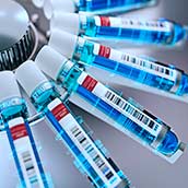 Test de Portadores o Test de Compatibilidad Genética